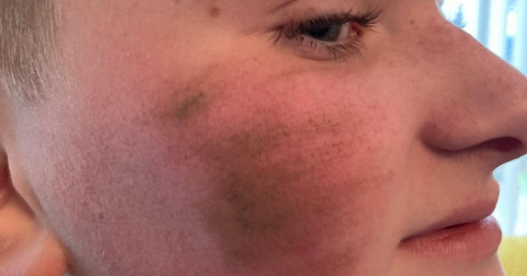 18 cases of alleged bullying reported at school where parents pulled son out after attacks