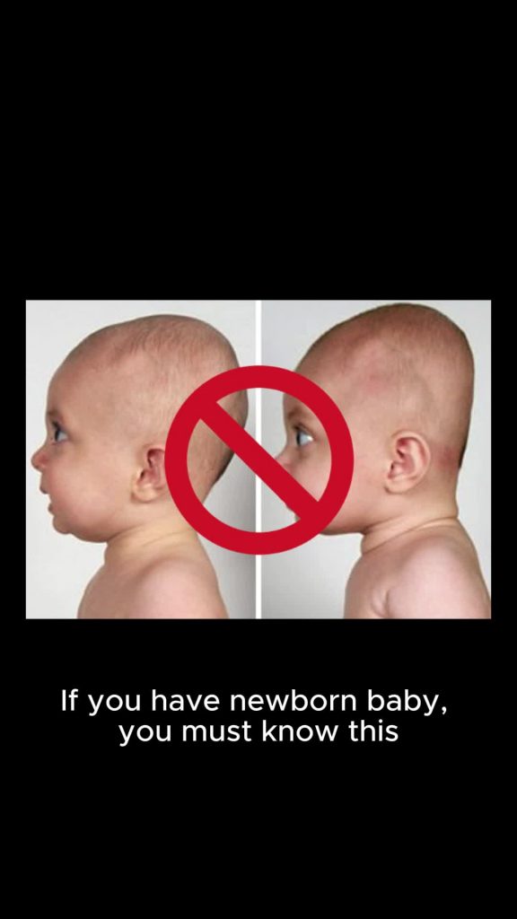 @babytipsg If you have newborn baby, you must know what Flat Head Syndrome is an...