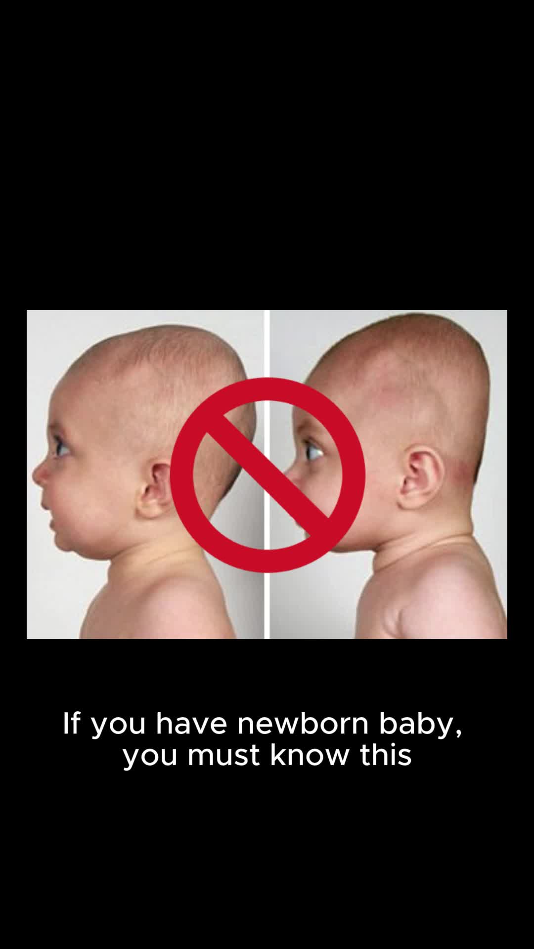 @babytipsg If you have newborn baby, you must know what Flat Head Syndrome is an...