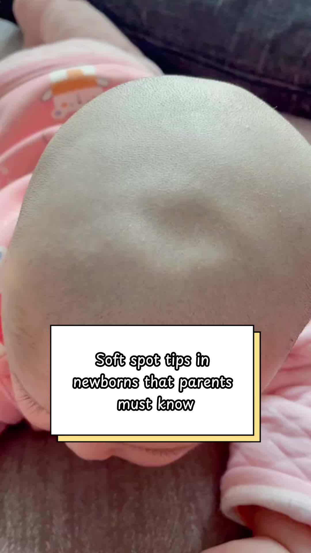 @babytipsg Soft spot tips in newborns that parents must know #softspot #parentin...