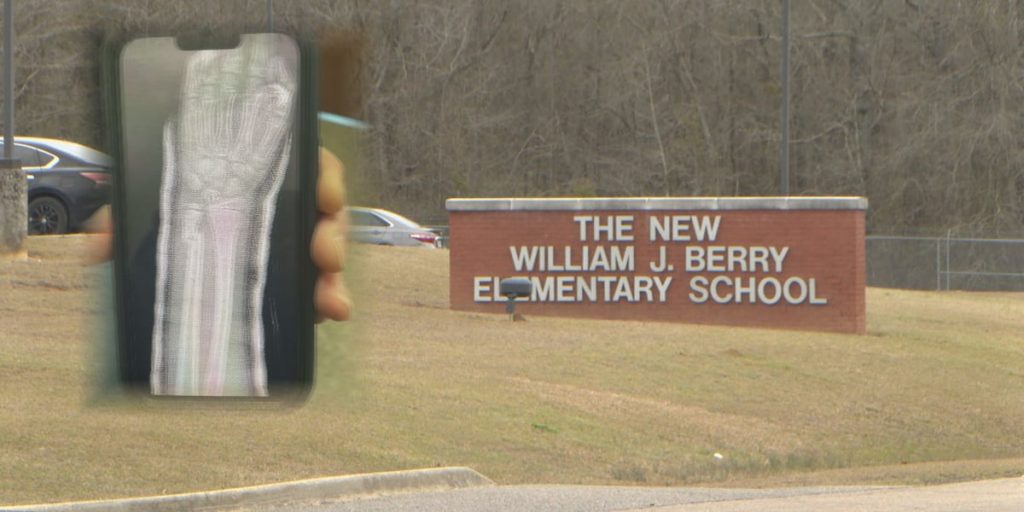 Mother demanding answers after she says her son’s arm was broken while being paddled at school