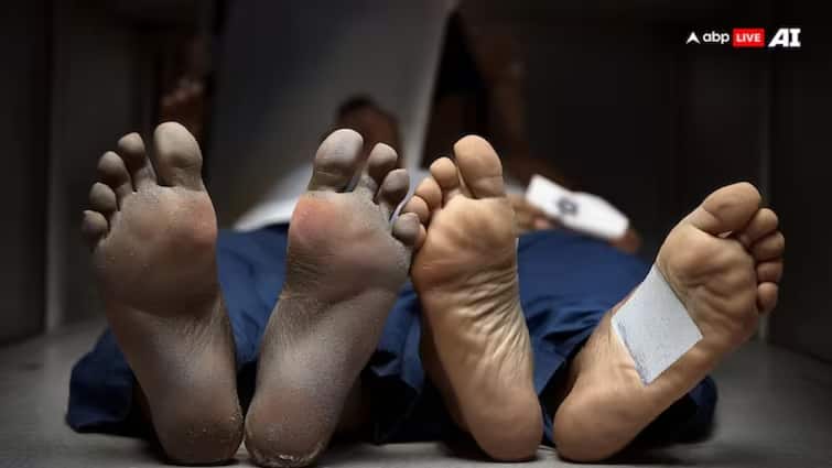 UP Man Accompanying Dead Father Passes Away After Suffering Heart Attack, Both Buried Together