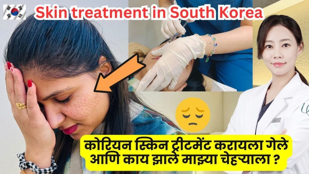 कोरियन स्किन ट्रीटमेंट करायला गेले आणि काय झाले माझ्या चेहऱ्याला ? | Skin treatment in Korea | #1232