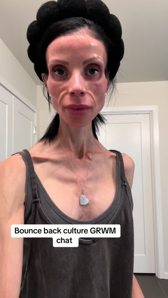 @healthyish_mama Lets chat about our society’s bounceback culture when it comes ...