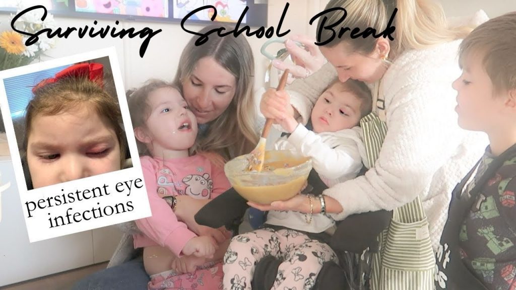 WHY IS THIS HAPPENING TO HER EYE? Long Awaited Appointment - Special Needs Mom Life