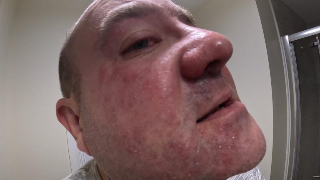 What Happened To Your Face