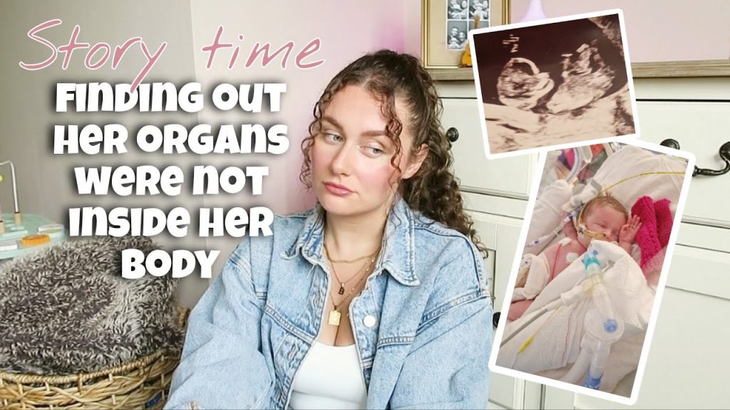 Gastroschisis Pregnancy journey & getting the diagnosis | Story time Part 1 | UK NICU mum