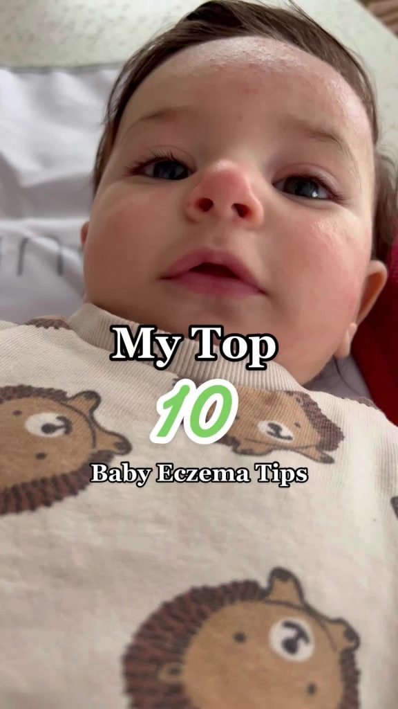@coolbabymama This is how I control my baby’s eczema  #babyeczema #eczemababy #e...