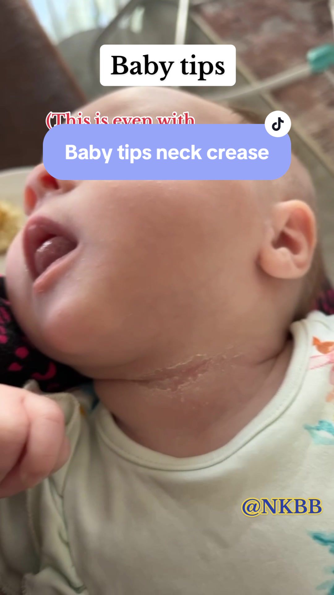 @nannykellybb Some babies are more sensitive and more prone to skin irratations ...