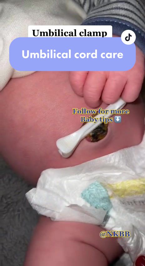 @nannykellybb We don’t recommend bathing the first week of life anyway but if yo...