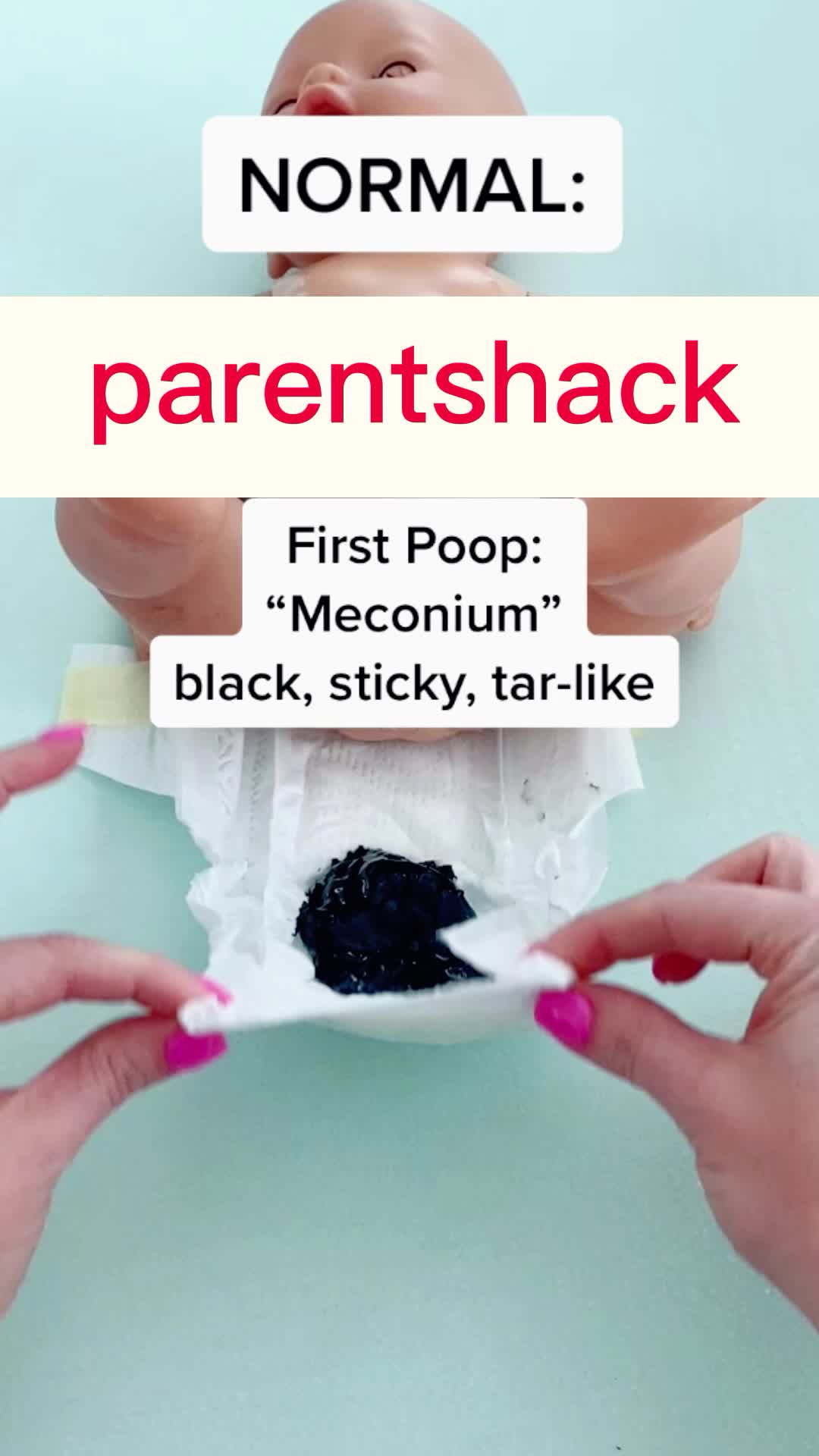 @parentshack about baby: normal #newborn #newbaby #babytips #momhack #parenthack...