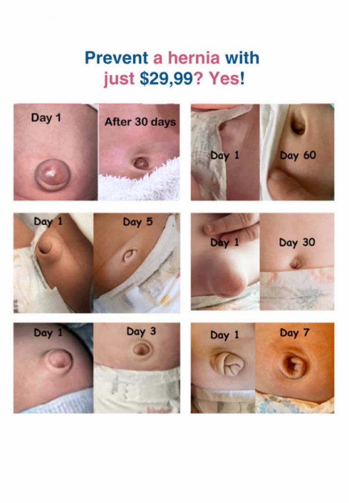 @babybellybuttonshaper  Like if you found this helpful! Subscribe @babybellybutt...