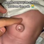 @gigisvloggaza Hello my friends, I am upset because my baby has an umbilical her...