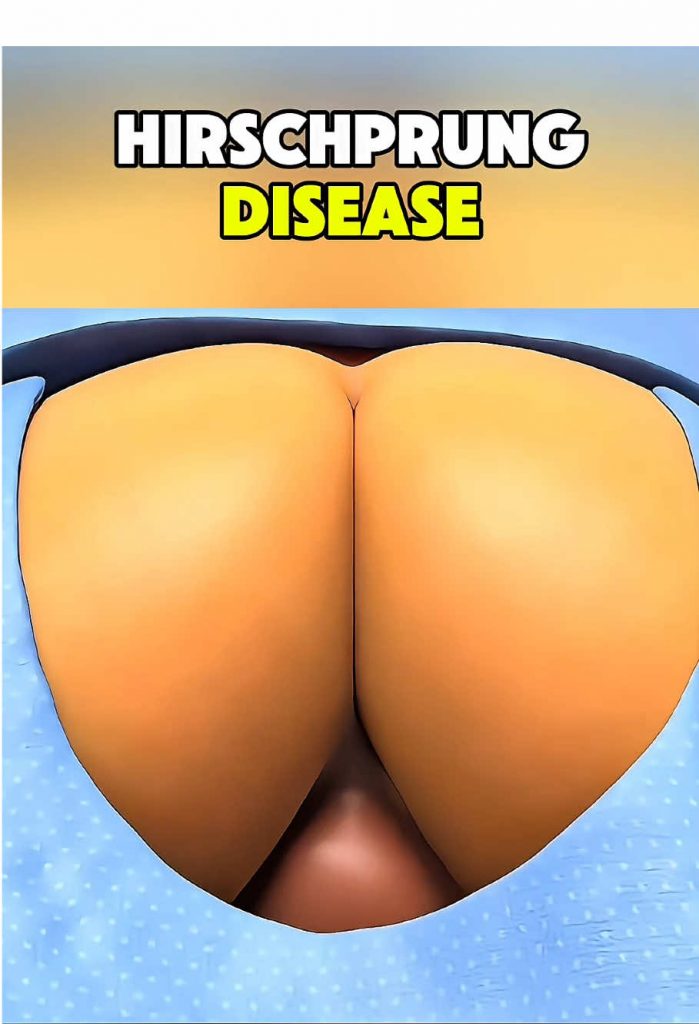 @medical.informati6093 Ever wondered why some babies struggle with constant con...