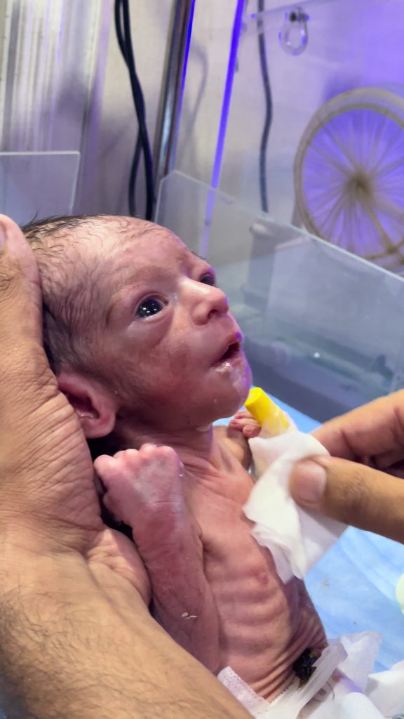 @thedoctor264 Burping Tips for Baby After Feeding Always burp your baby after fe...