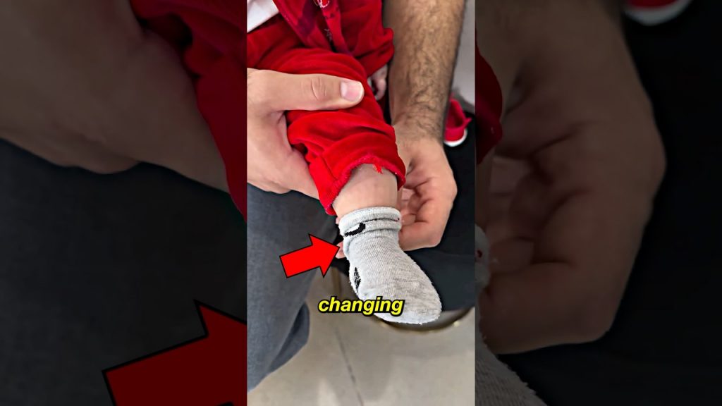 The Cutest Rare Condition Ever #shorts