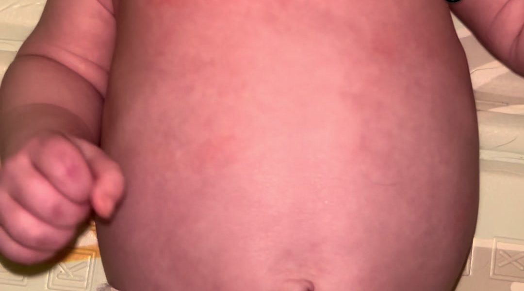 @saff.ia6 Poor baby had his first trip to hospital at 6 weeks old  I will always...