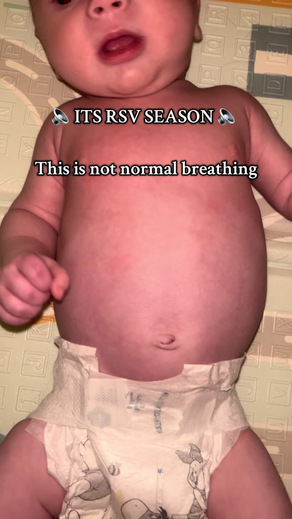 @saff.ia6 Poor baby had his first trip to hospital at 6 weeks old  I will always...